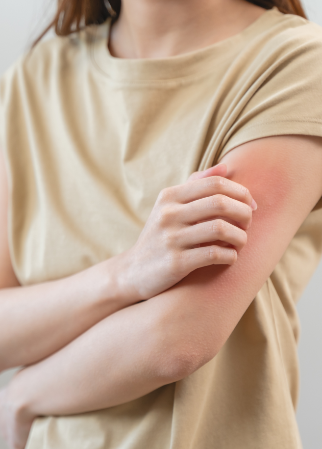 Person experiencing allergic skin reaction